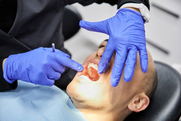 Best Emergency Root Canal Treatment in Barview, OR